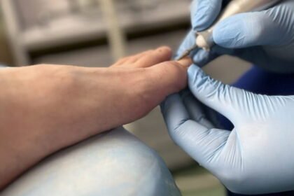 найефективніший засіб від грибка нігтів відгуки